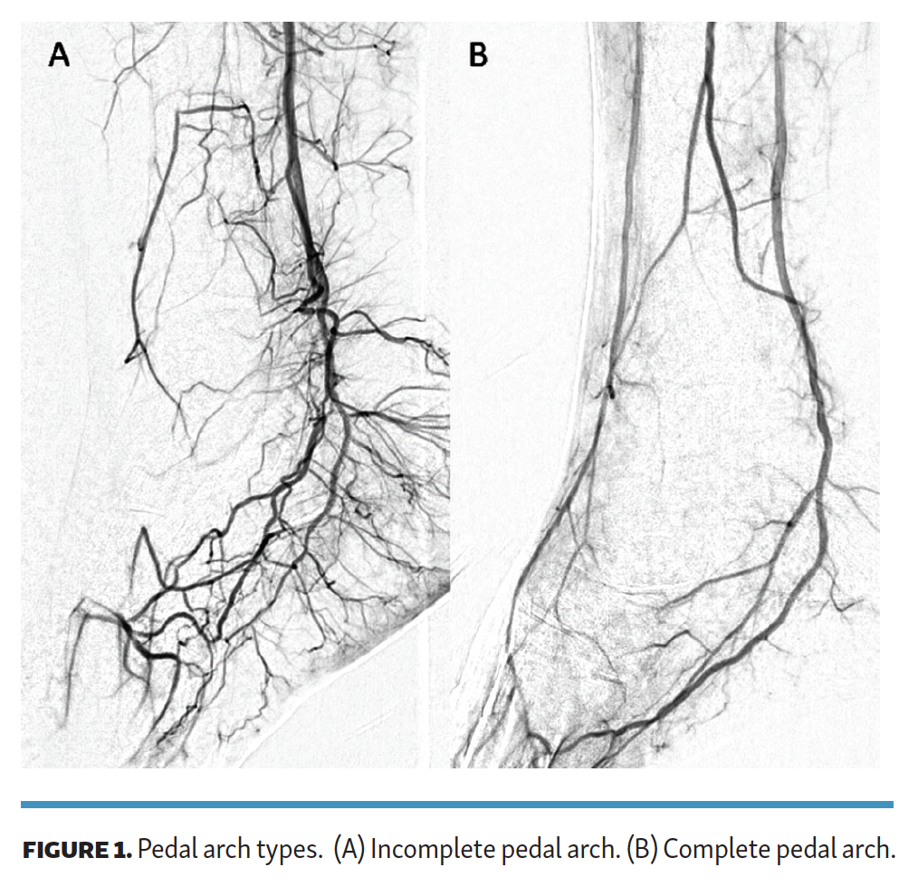Leung Impact of Pedal Arch Patency on BTA Revascularization Fig 1