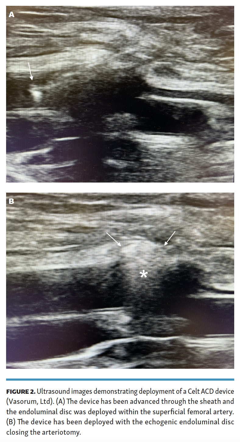 Patel - Ultrasound Figure 2